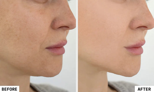 12 Must Have Skincare Essentials That Actually Make You Look Younger (And Safe to Use at Home)